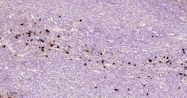 Human IgG2 Antibody in Immunohistochemistry (Paraffin) (IHC (P))