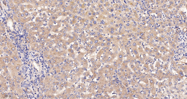 C4BPB Antibody in Immunohistochemistry (Paraffin) (IHC (P))