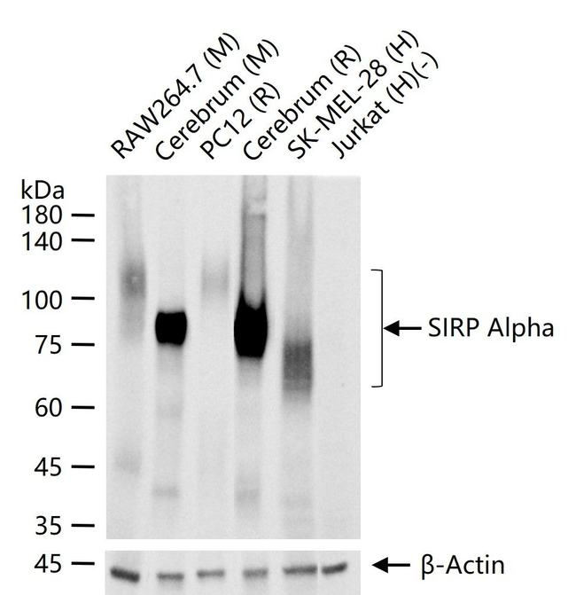 SIRP alpha Antibody in Western Blot (WB)