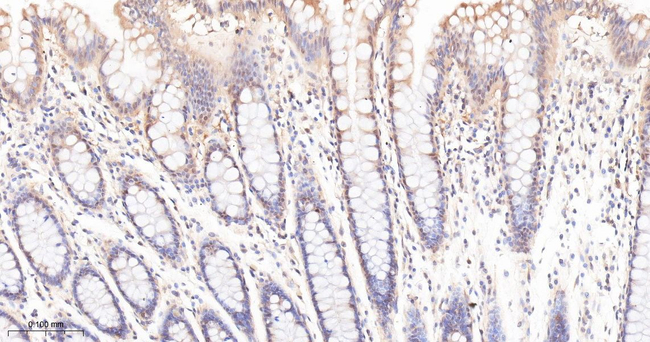 PP1 beta Antibody in Immunohistochemistry (Paraffin) (IHC (P))