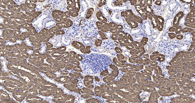 FBP1 Antibody in Immunohistochemistry (Paraffin) (IHC (P))