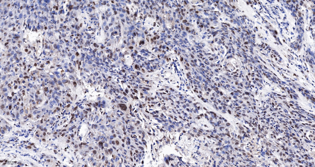 SRSF3 Antibody in Immunohistochemistry (Paraffin) (IHC (P))