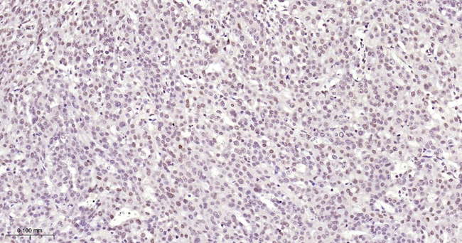 METTL3 Antibody in Immunohistochemistry (Paraffin) (IHC (P))