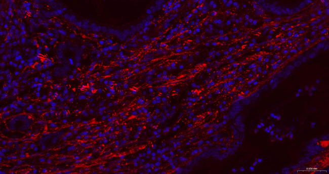 Fibronectin Antibody in Immunohistochemistry (Paraffin) (IHC (P))