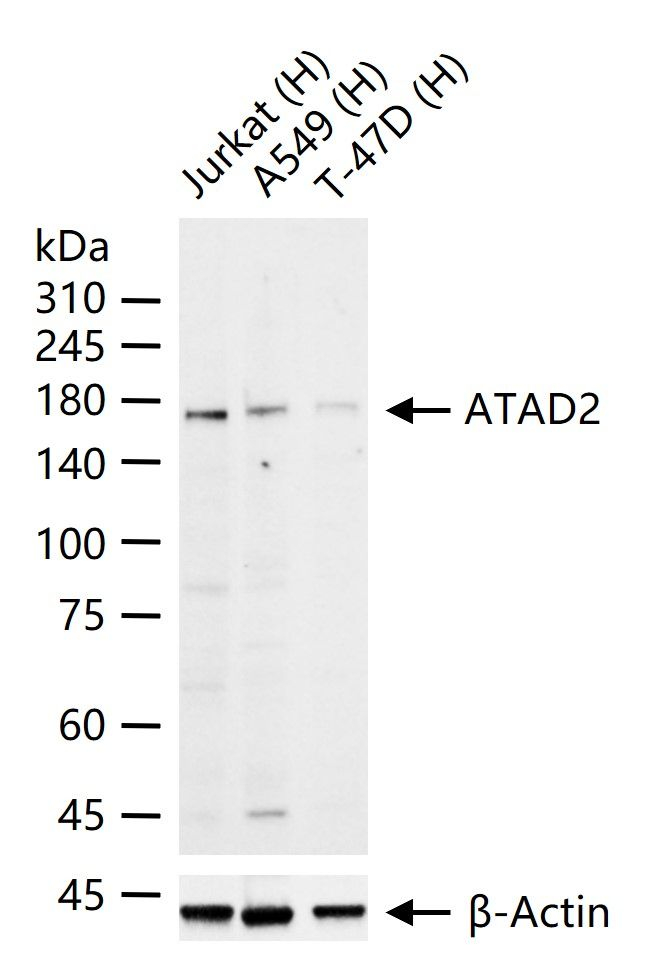 ATAD2 Antibody in Western Blot (WB)