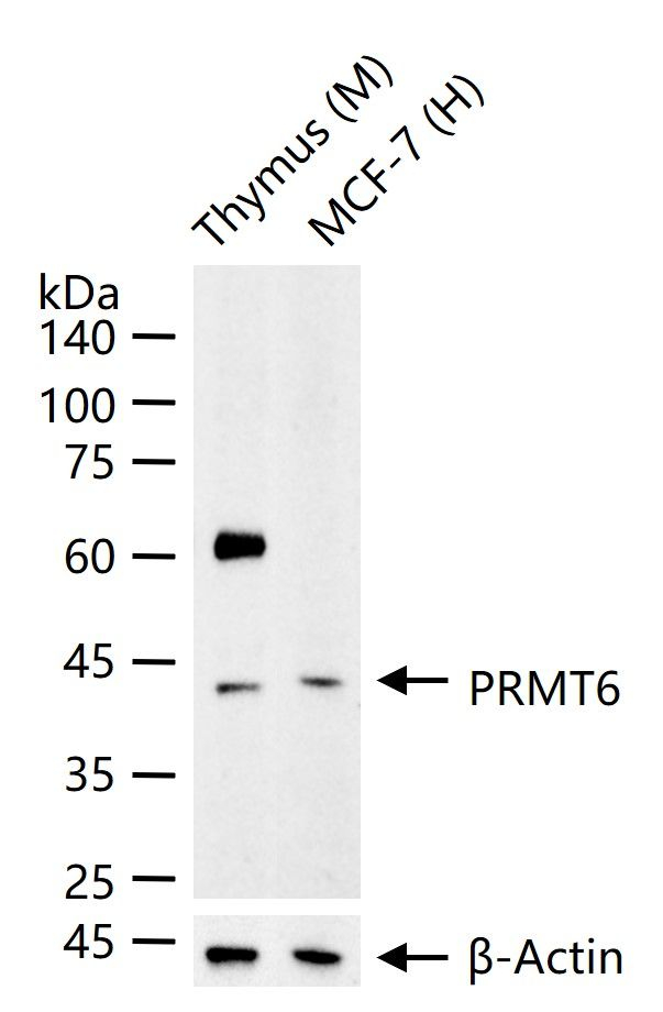 PRMT6 Antibody in Western Blot (WB)