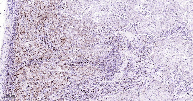HAT1 Antibody in Immunohistochemistry (Paraffin) (IHC (P))