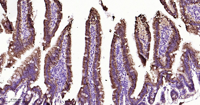 MAOA Antibody in Immunohistochemistry (Paraffin) (IHC (P))