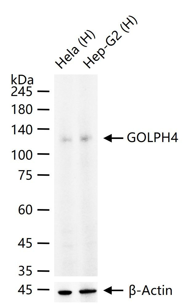 GOLIM4 Antibody in Western Blot (WB)