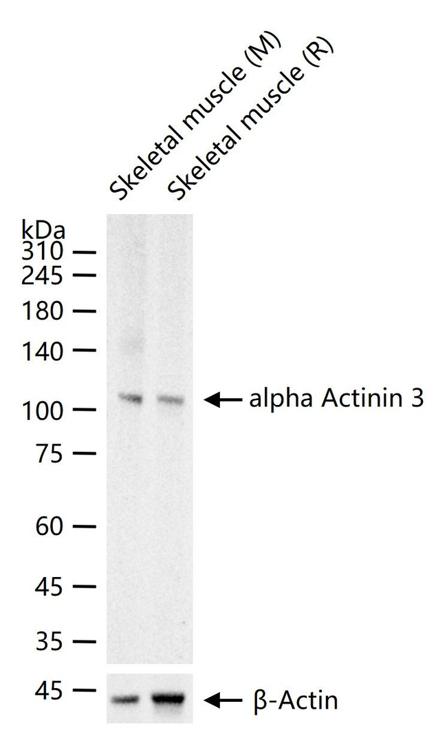 alpha Actinin 3 Antibody in Western Blot (WB)