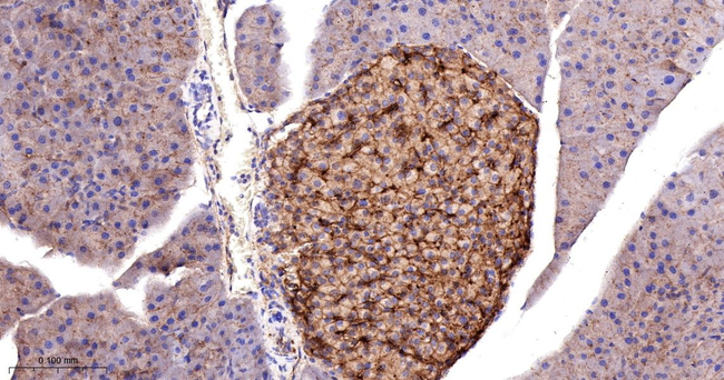 GNB2 Antibody in Immunohistochemistry (Paraffin) (IHC (P))