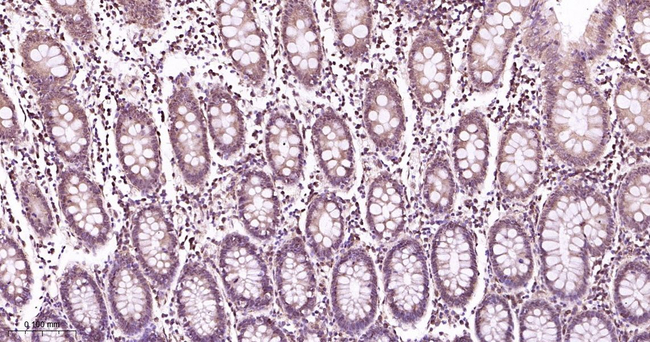 PSMD14 Antibody in Immunohistochemistry (Paraffin) (IHC (P))