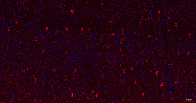 ABAT Antibody in Immunohistochemistry (Paraffin) (IHC (P))