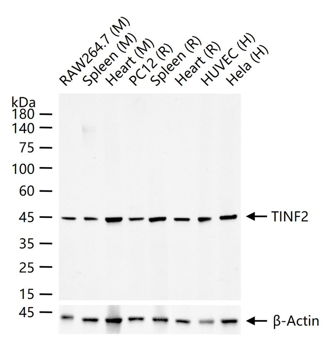TIN2 Antibody in Western Blot (WB)