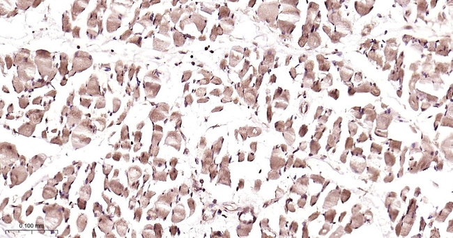 PSMA2 Antibody in Immunohistochemistry (Paraffin) (IHC (P))