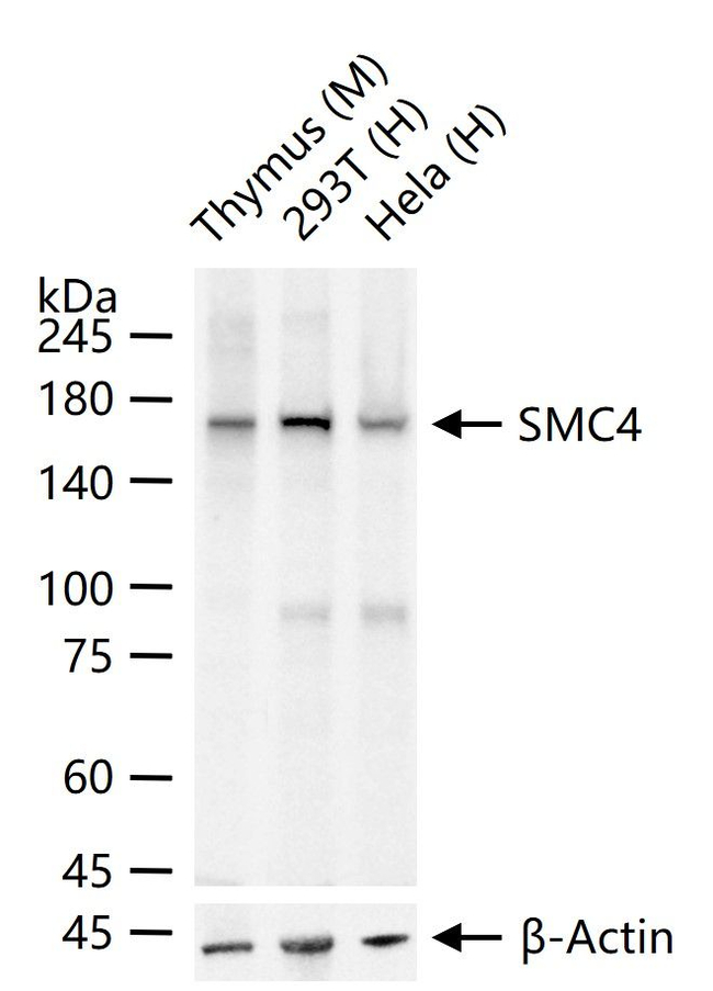 SMC4 Antibody in Western Blot (WB)