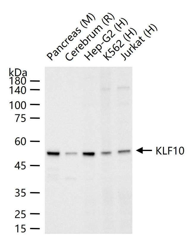 KLF10 Antibody in Western Blot (WB)