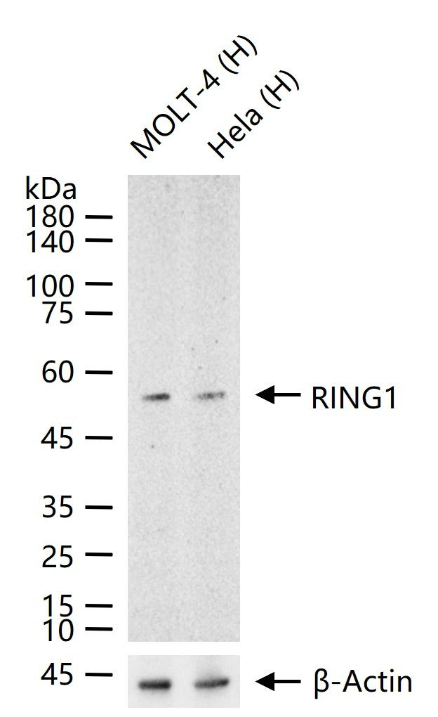RING1 Antibody in Western Blot (WB)