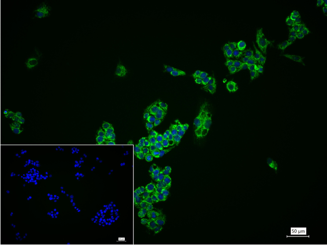 TOMM22 Antibody in Immunocytochemistry (ICC/IF)