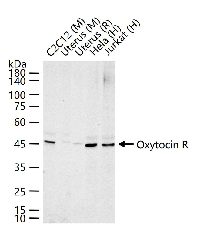 Oxytocin Receptor Antibody in Western Blot (WB)