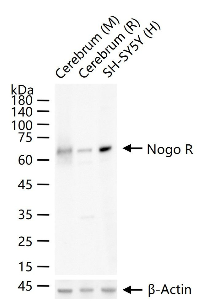 Nogo Receptor Antibody in Western Blot (WB)