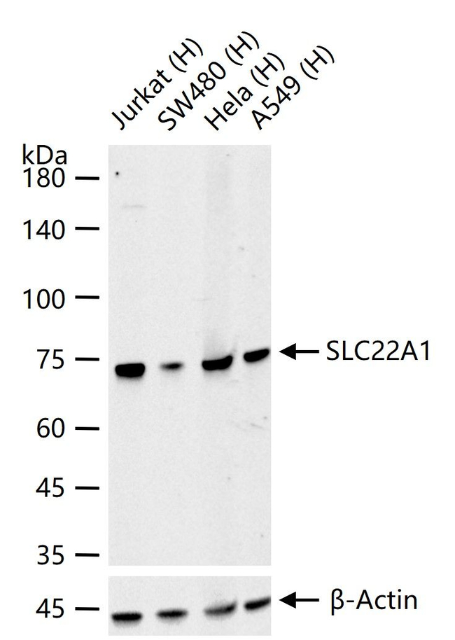 SLC22A1 Antibody in Western Blot (WB)