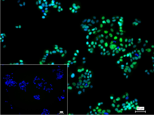 ANP32B Antibody in Immunocytochemistry (ICC/IF)