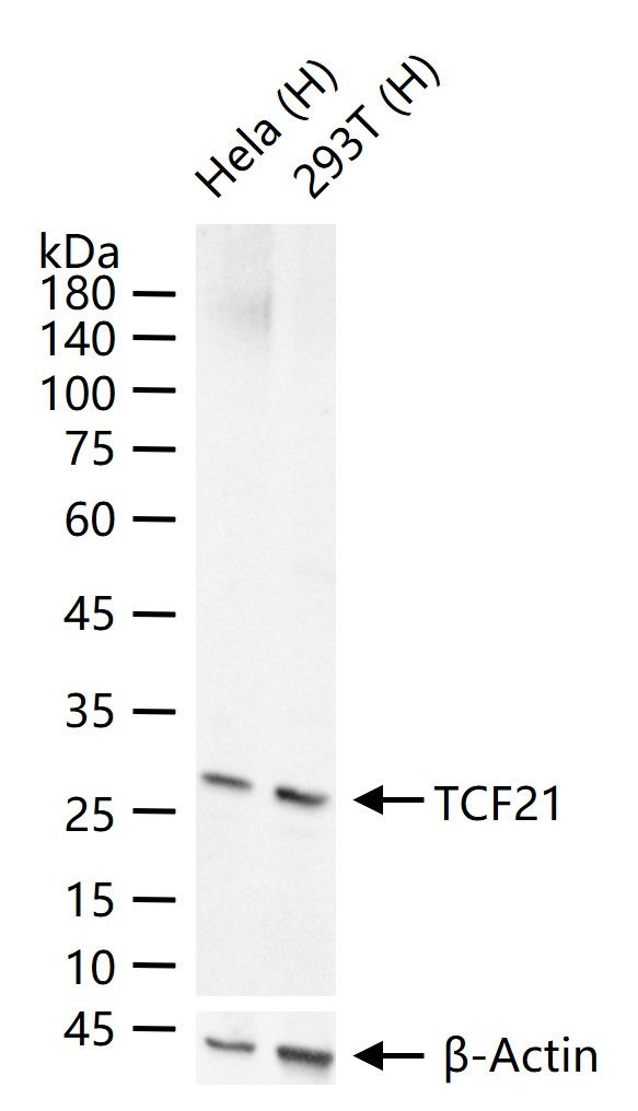 TCF21 Antibody in Western Blot (WB)