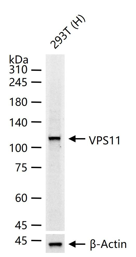 VPS11 Antibody in Western Blot (WB)