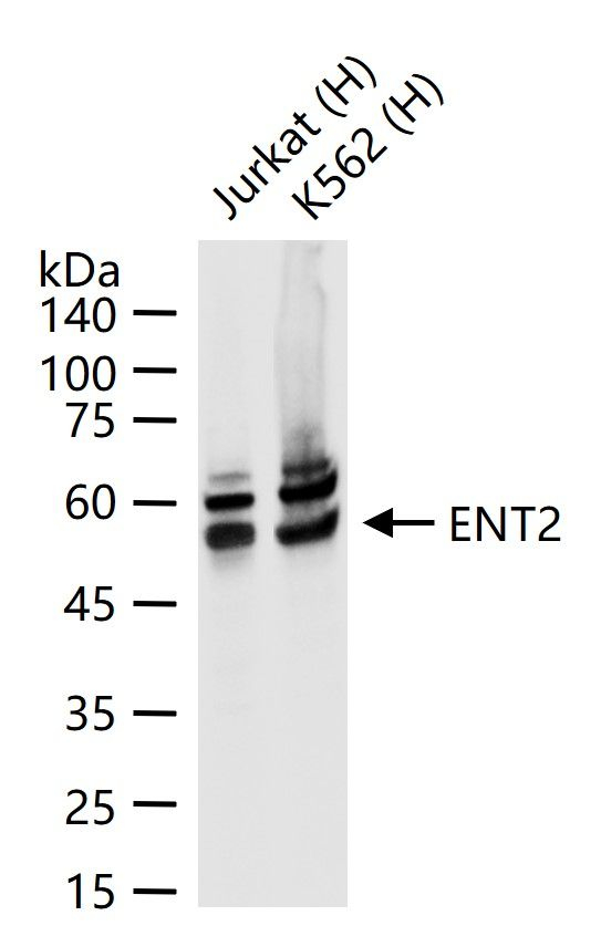 ENT2 Antibody in Western Blot (WB)