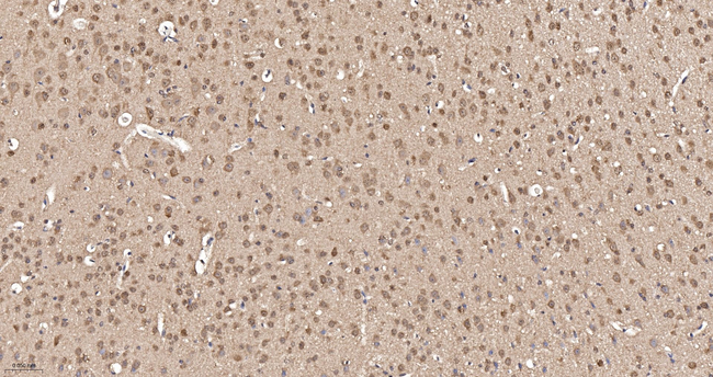 Cyclophilin 40 Antibody in Immunohistochemistry (Paraffin) (IHC (P))