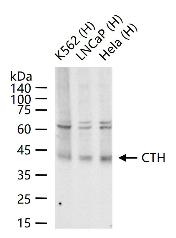 CTH Antibody in Western Blot (WB)