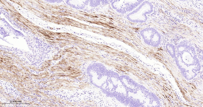 MYL9 Antibody in Immunohistochemistry (Paraffin) (IHC (P))