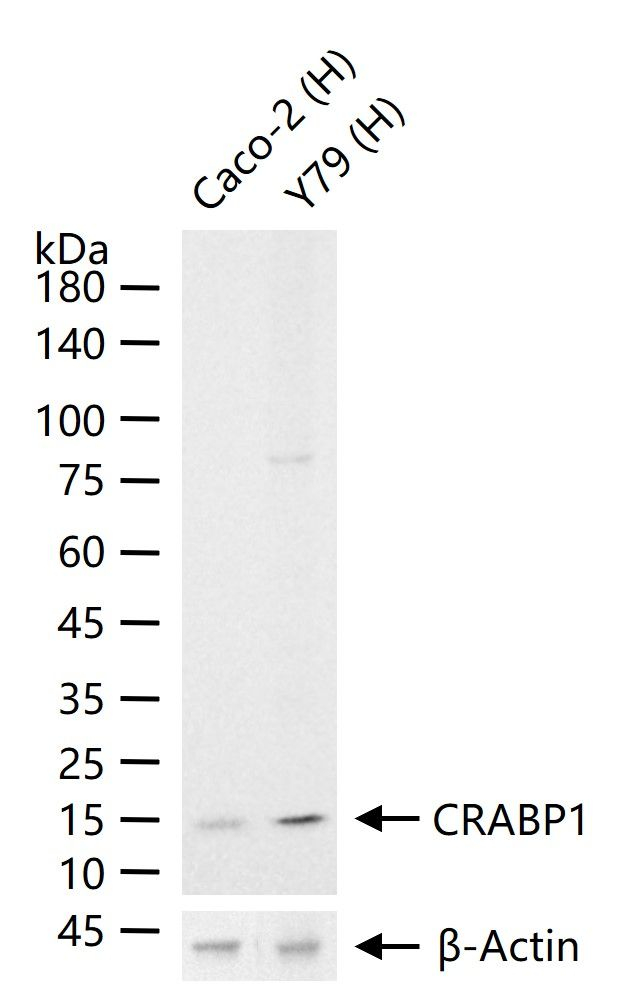 CRABP1 Antibody in Western Blot (WB)