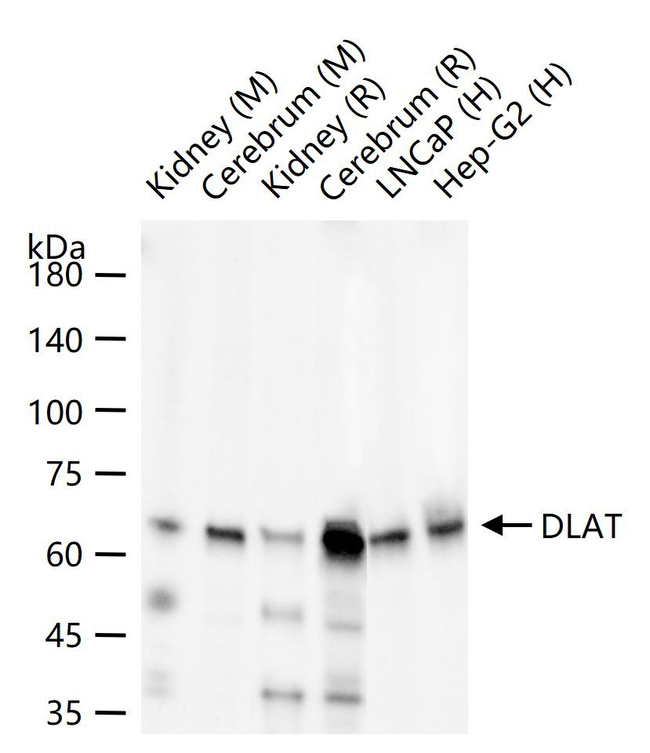 DLAT Antibody in Western Blot (WB)