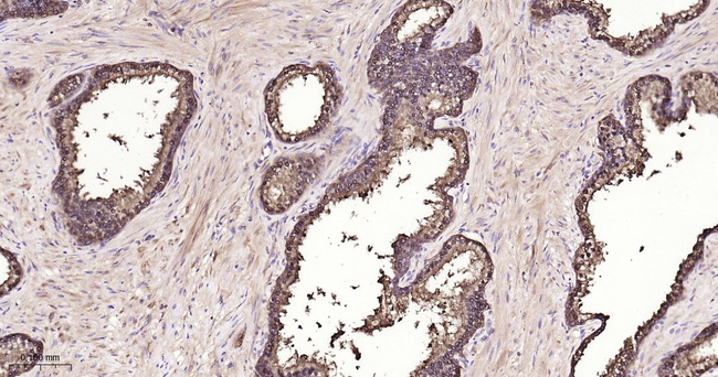 IDH1 Antibody in Immunohistochemistry (Paraffin) (IHC (P))