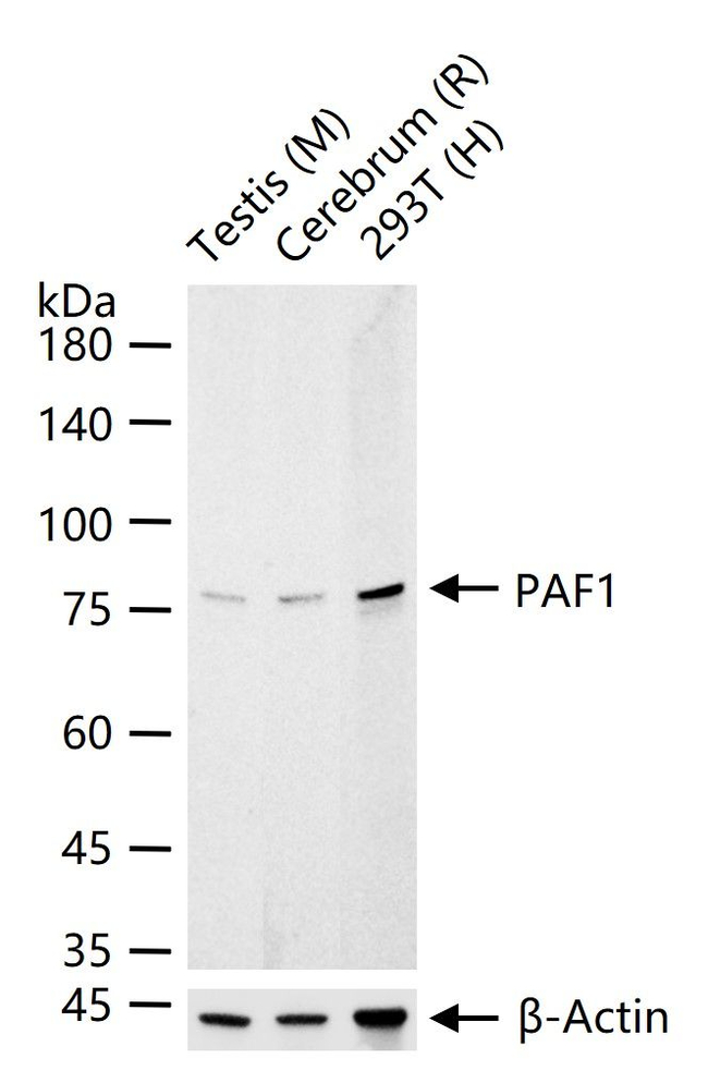 PAF1 Antibody in Western Blot (WB)