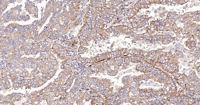 TSC1 Antibody in Immunohistochemistry (Paraffin) (IHC (P))