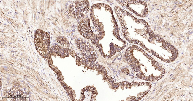 TMPRSS2 Antibody in Immunohistochemistry (Paraffin) (IHC (P))