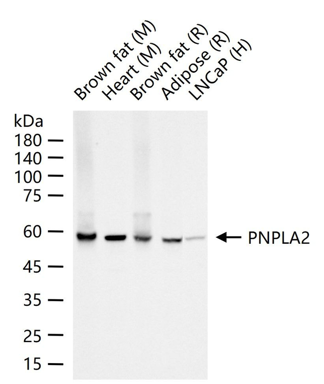 ATGL Antibody in Western Blot (WB)