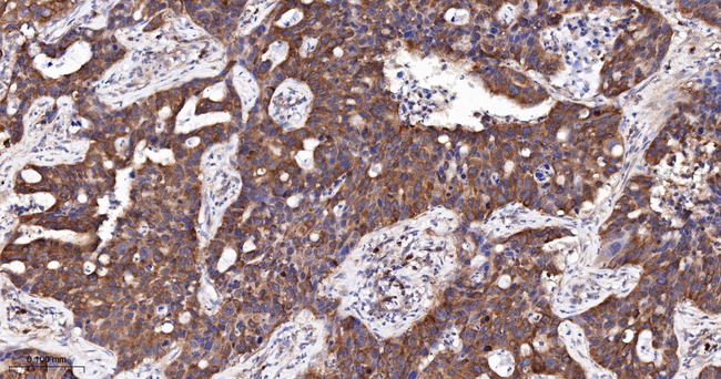 LGR6 Antibody in Immunohistochemistry (Paraffin) (IHC (P))