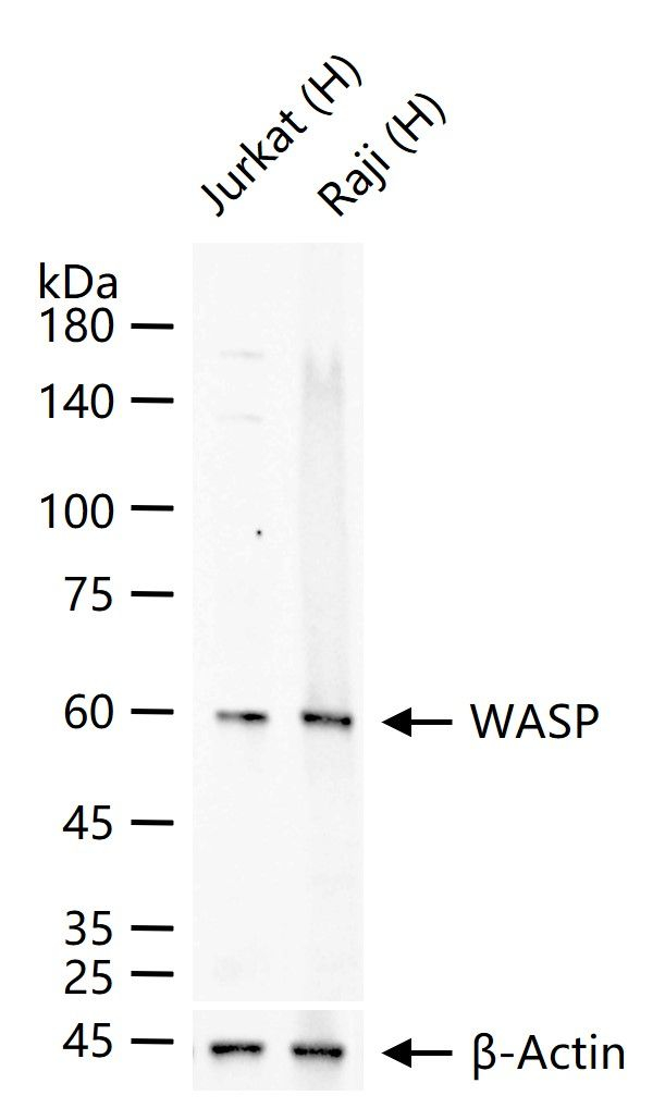 WASP Antibody in Western Blot (WB)