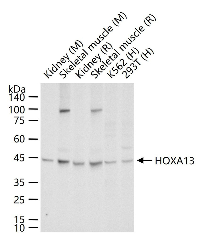 HOXA13 Antibody in Western Blot (WB)
