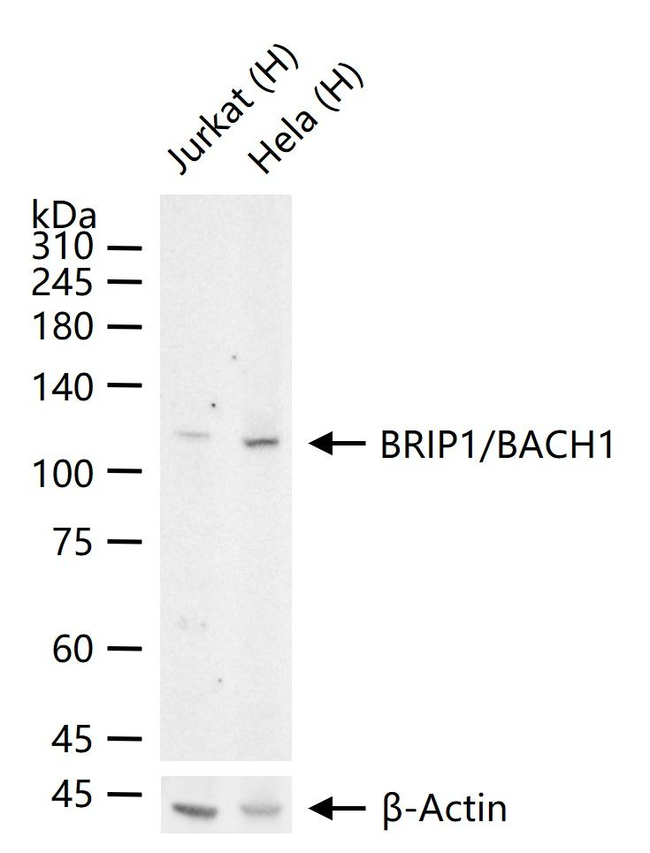 BRIP1 Antibody in Western Blot (WB)