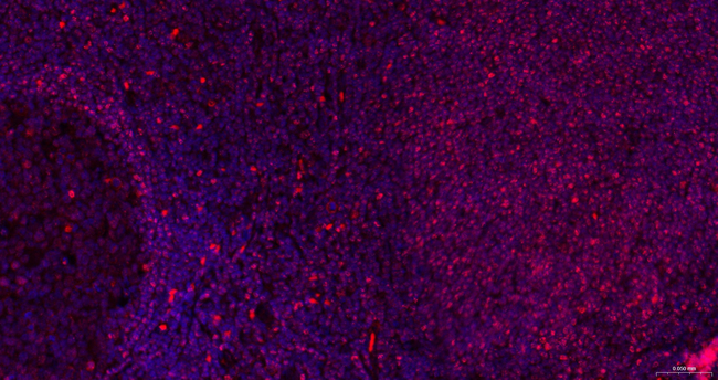 SMCHD1 Antibody in Immunohistochemistry (Paraffin) (IHC (P))