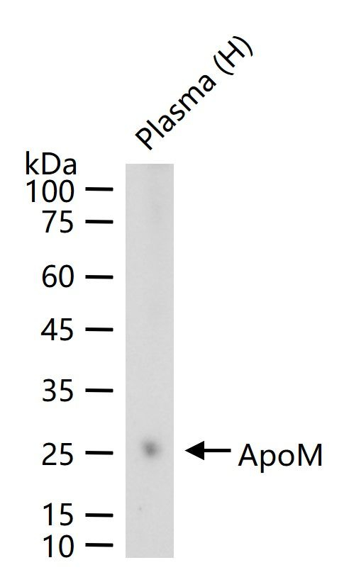 Apolipoprotein M Antibody in Western Blot (WB)