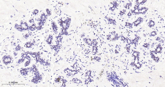 AP2 alpha Antibody in Immunohistochemistry (Paraffin) (IHC (P))