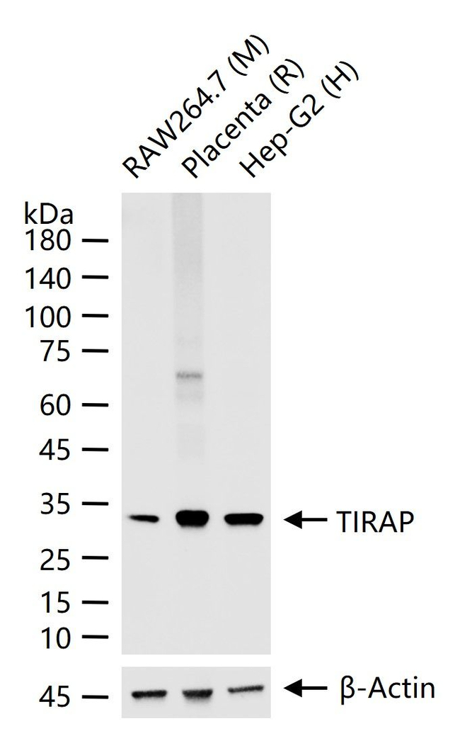 TIRAP Antibody in Western Blot (WB)