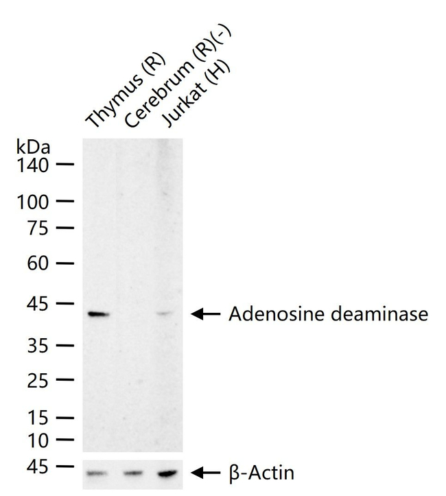 Adenosine Deaminase Antibody in Western Blot (WB)