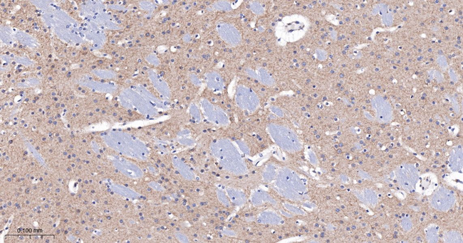CHRM2 Antibody in Immunohistochemistry (Paraffin) (IHC (P))